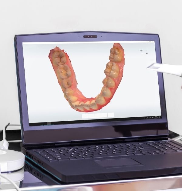 Dreidimensionale Röntgenaufnahme eines menschlichen Unterkiefers auf dem Bildschirm eines Laptops