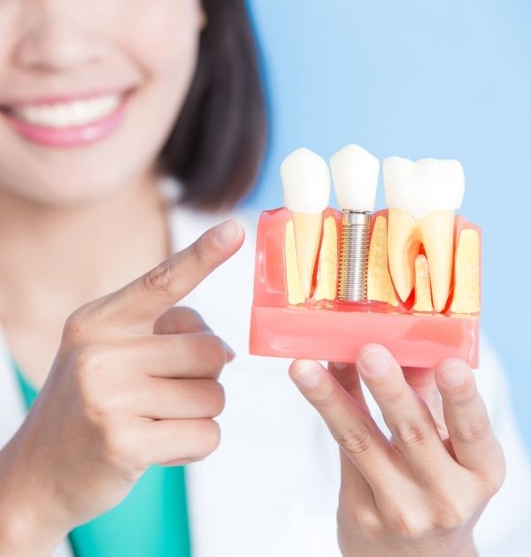 Zahnärztin demonstriert ein Zahnimplantat am Modell eines menschlichen Gebisses