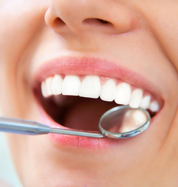 Zum Lächeln geöffneter Mund mit weißen Zähnen, während eine Zahnuntersuchung mit Dentalspiegel durchgeführt wird