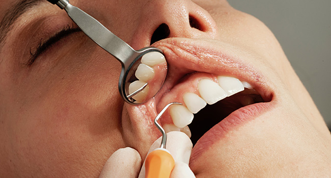 Zahnmedizinische Untersuchung mit Dentalspiegel und Scaler