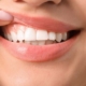 Frau zeigt ihr Zahnfleisch